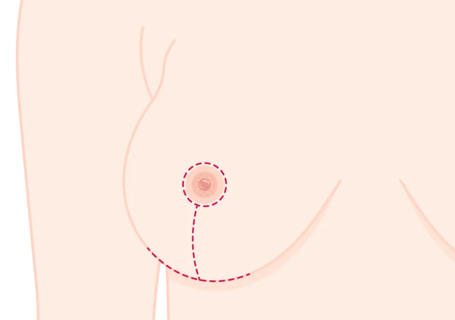 通常法